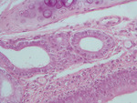 MISSING THUMBNAIL